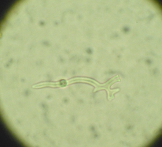 Da determinare (Antrodia albida)